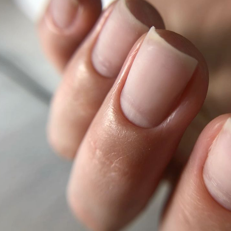 Retiradas de esmaltado